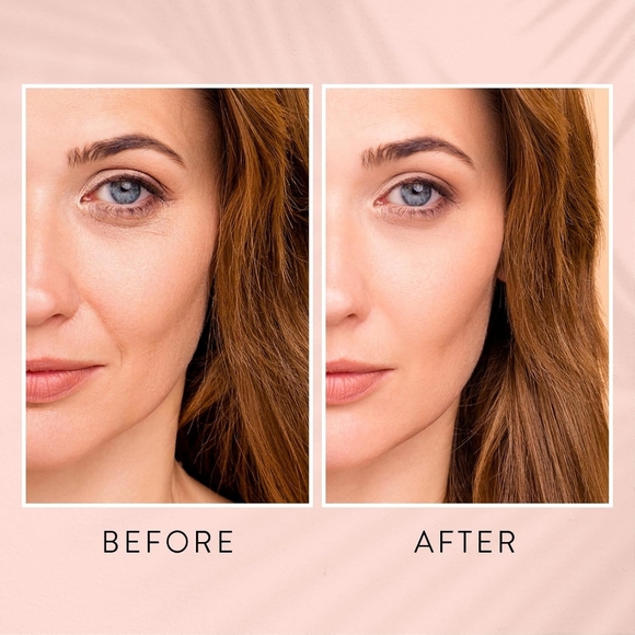 Retinol Serum for Face - for fine lines, wrinkles, dark spots - Picture 5 of 9